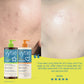 Vytle™ Daily Ceramide Moisturiser